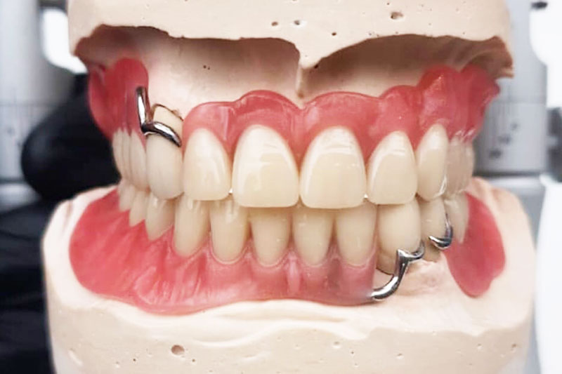 https://denturedesignlab.co.uk/wp-content/uploads/2021/01/Partial-Denture-1.jpg