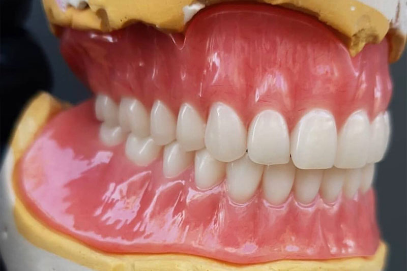 https://denturedesignlab.co.uk/wp-content/uploads/2021/01/complete-Denture-1.jpg