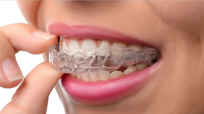 https://denturedesignlab.co.uk/wp-content/uploads/2021/02/mouth-guard.jpg